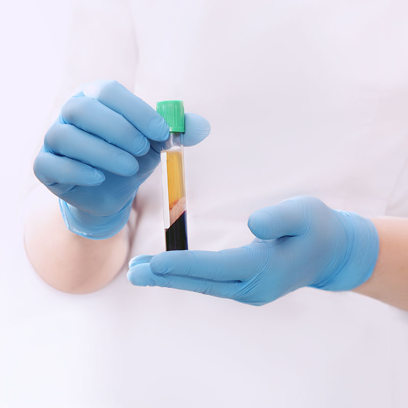 PRP – Vampirlifting mit Eigenblut